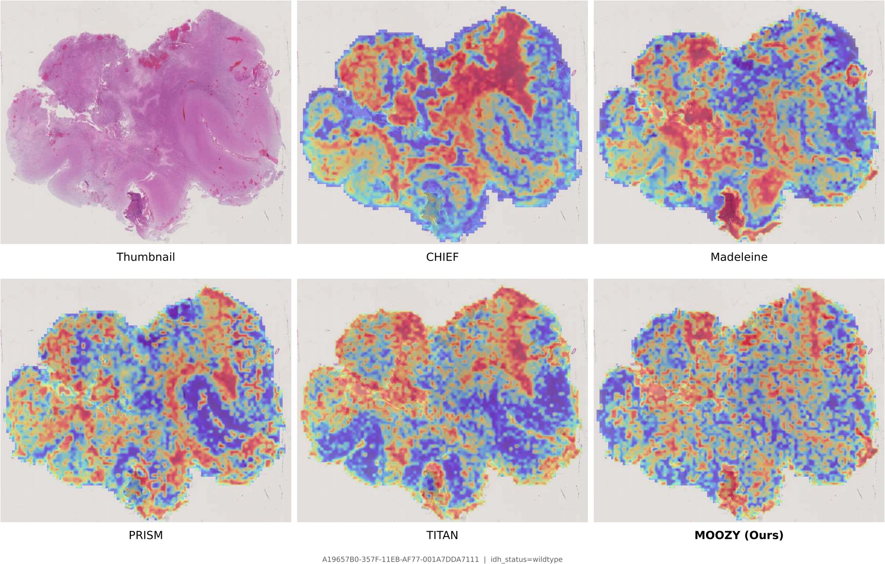 Attention map comparison 2