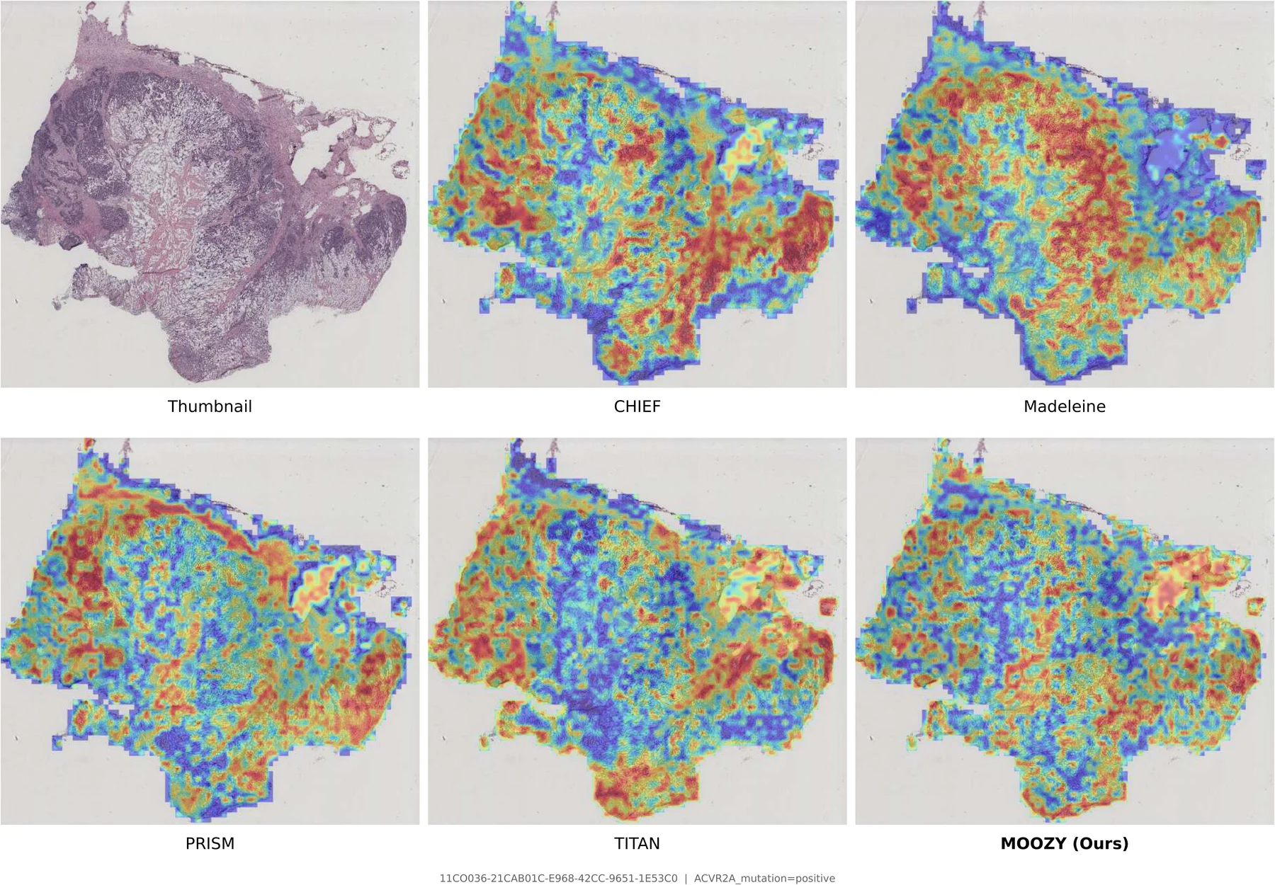 Attention map comparison 3