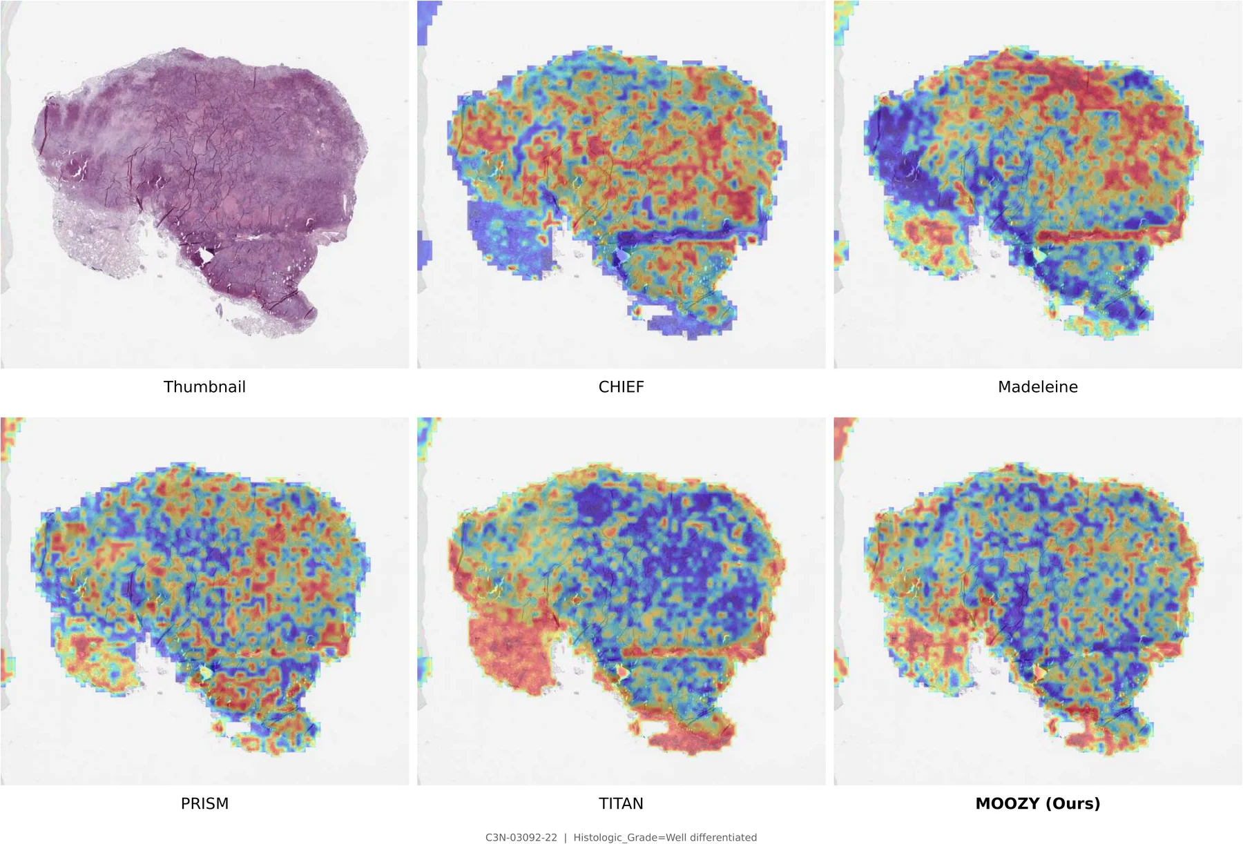 Attention map comparison 4