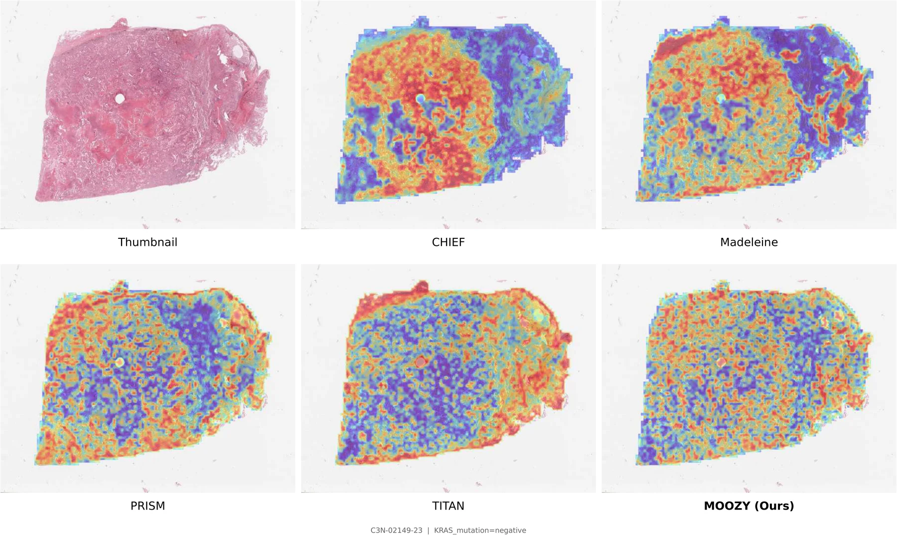 Attention map comparison 5