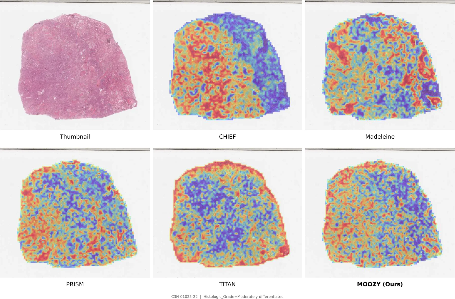 Attention map comparison 6